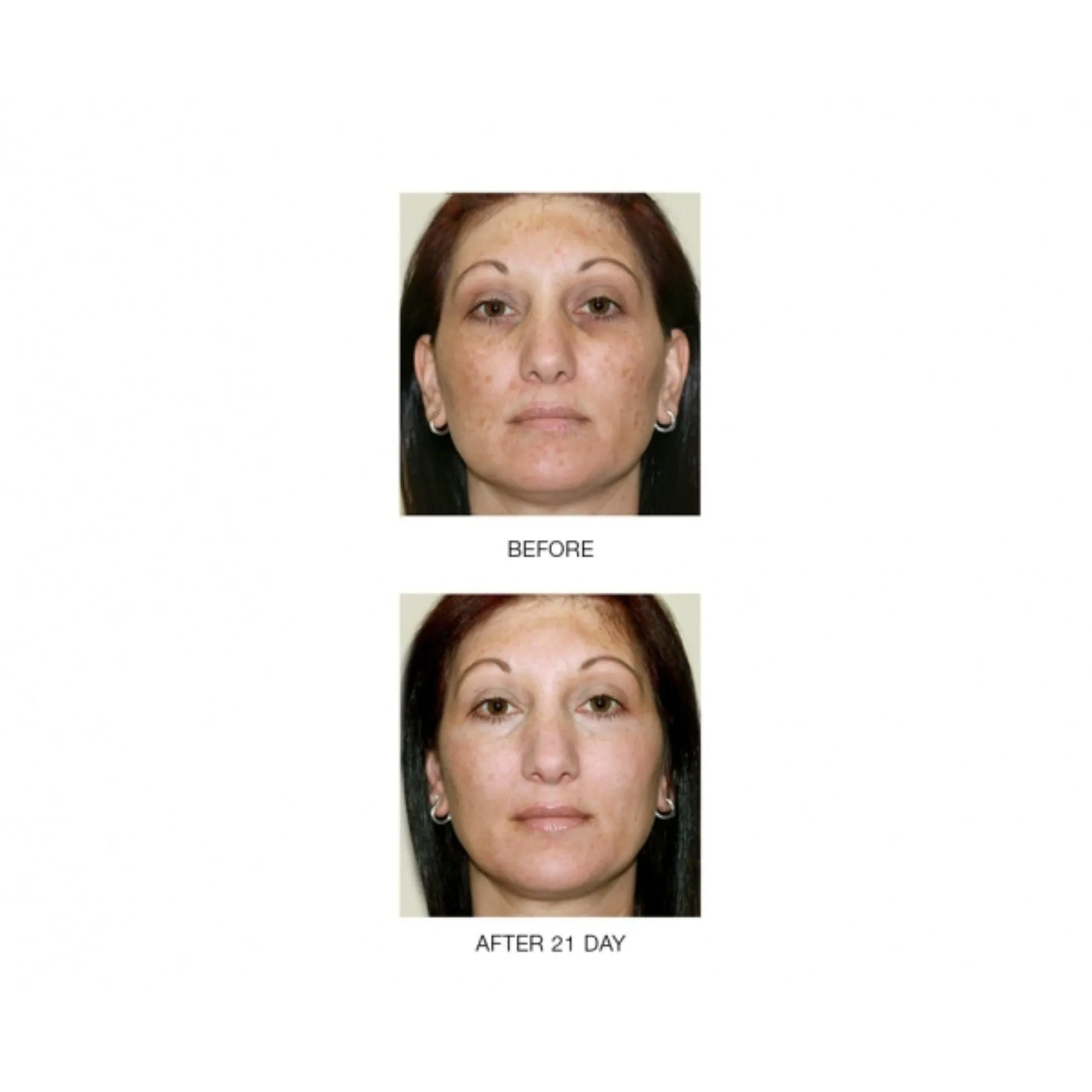 Wrinkle Zero Night Renewal Serum Mini- Retinol- Vitamin C -Growth factors- Peptides